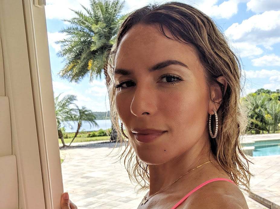 Here's what helped me treat hyperpigmentation and acne scars